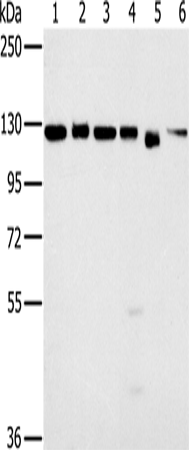 Anti-Matrin 3 Rabbit Polyclonal Antibody
