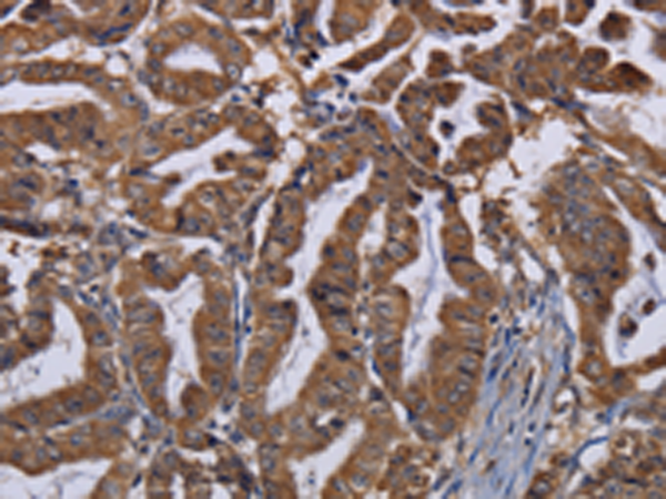Anti-MCT 1 Rabbit Polyclonal Antibody