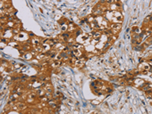 Anti-PSMC2 Rabbit Polyclonal Antibody