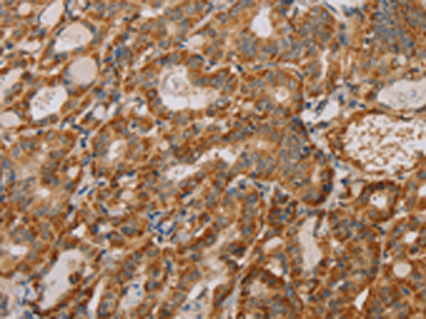 Anti-MTFR1 Rabbit Polyclonal Antibody