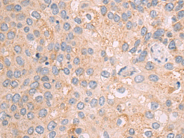 Anti-MTP18 Rabbit Polyclonal Antibody