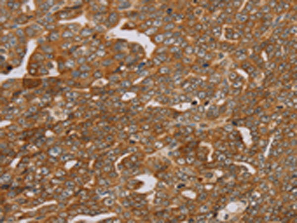 Anti-MyoGEF Rabbit Polyclonal Antibody