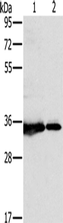 Anti-NDUFAF1 Rabbit Polyclonal Antibody