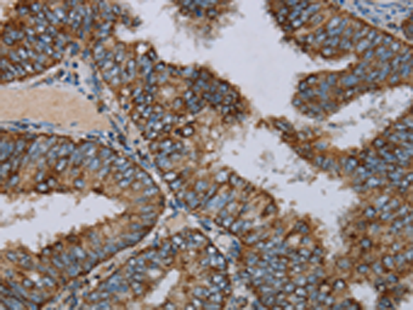 Anti-NDUFA9 Rabbit Polyclonal Antibody