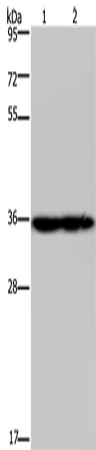 Anti-NDUFA9 Rabbit Polyclonal Antibody