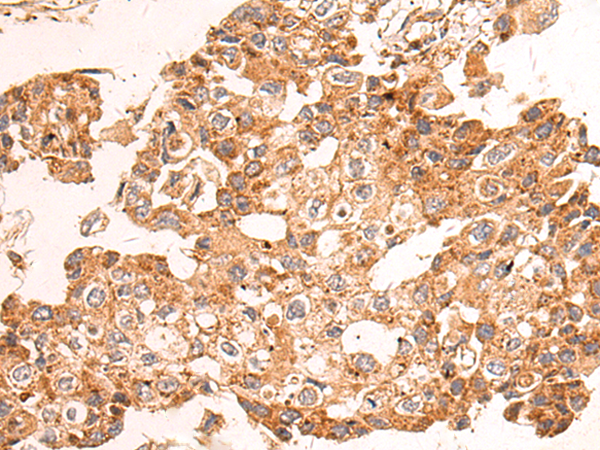 Anti-NDUFA2 Rabbit Polyclonal Antibody