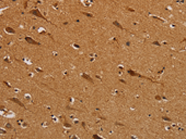 Anti-NDUFS5 Rabbit Polyclonal Antibody