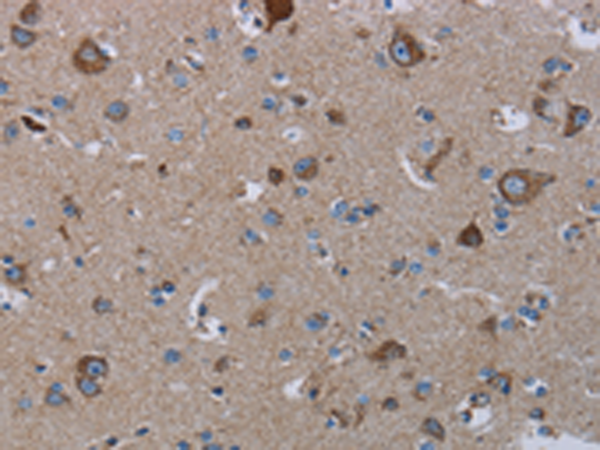 Anti-NDUFS8 Rabbit Polyclonal Antibody
