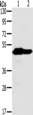 Anti-NDUFV1 Rabbit Polyclonal Antibody