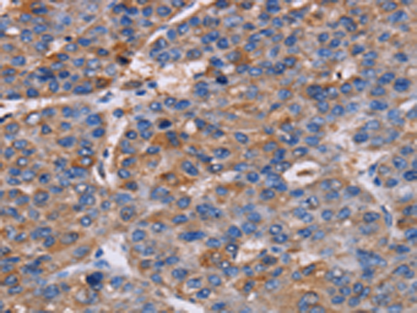 Anti-NPM3 Rabbit Polyclonal Antibody