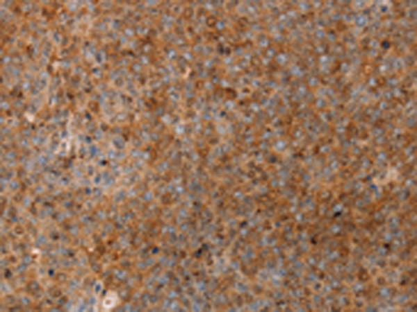 Anti-SERPINB2 Rabbit Polyclonal Antibody