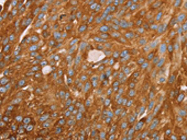 Anti-PAICS Rabbit Polyclonal Antibody
