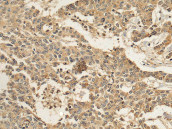 Anti-PCMT1 Rabbit Polyclonal Antibody