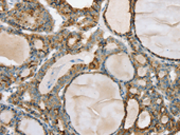 Anti-Phosphorylase B Rabbit Polyclonal Antibody
