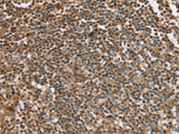Anti-PLS3 Rabbit Polyclonal Antibody