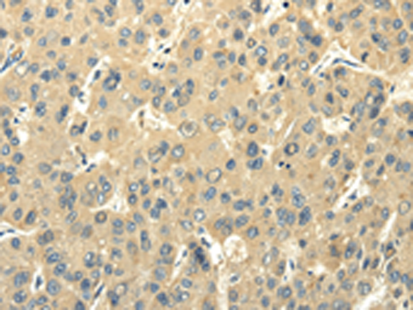 Anti-PMP2 Rabbit Polyclonal Antibody