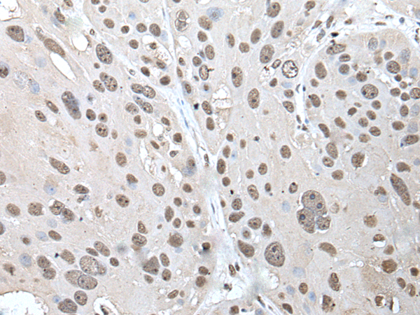 Anti-POT1 Rabbit Polyclonal Antibody