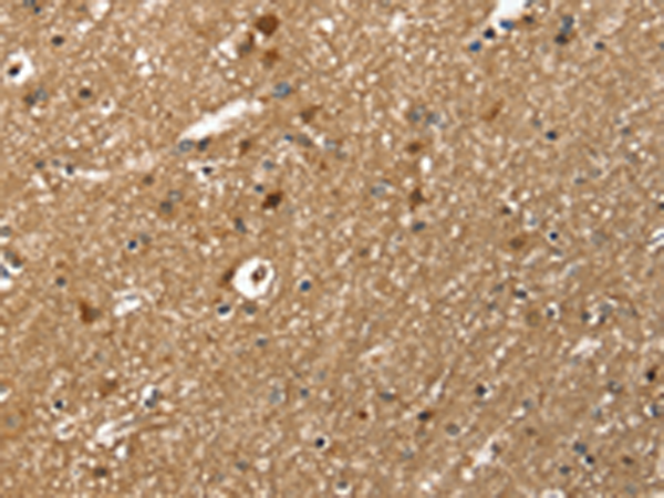 Anti-Twinfilin 1 Rabbit Polyclonal Antibody