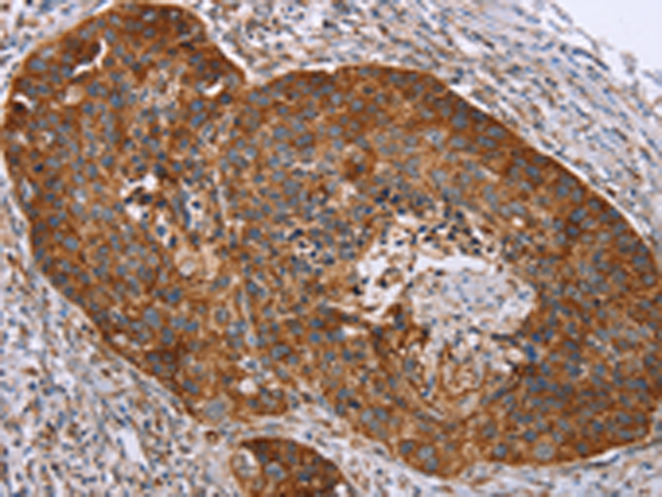 Anti-RMDN3 Rabbit Polyclonal Antibody