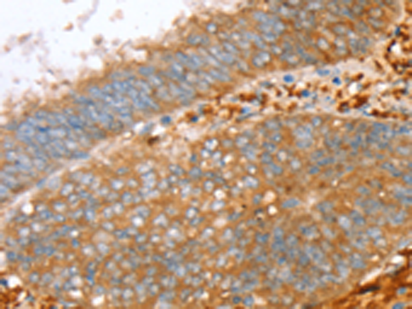 Anti-PTPN7 Rabbit Polyclonal Antibody