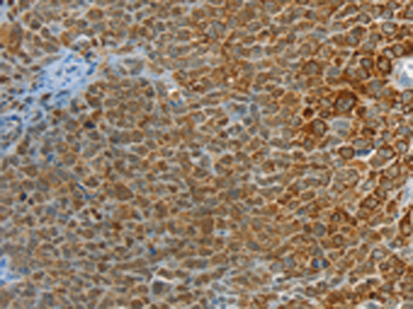 Anti-PTPN3 Rabbit Polyclonal Antibody