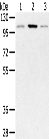 Anti-PYGM Rabbit Polyclonal Antibody