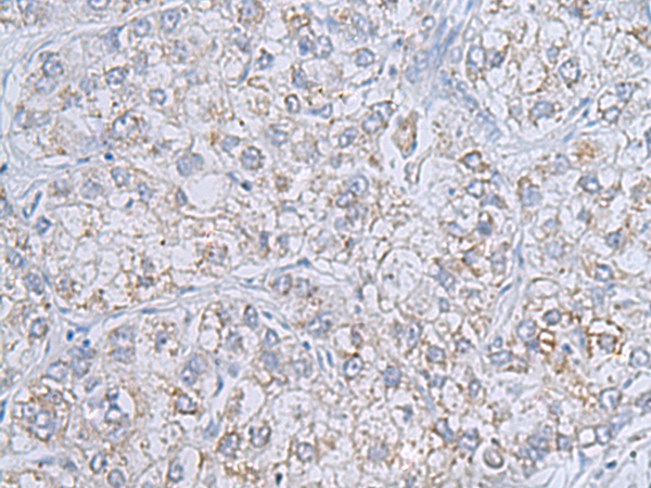 Anti-Rab20 Rabbit Polyclonal Antibody
