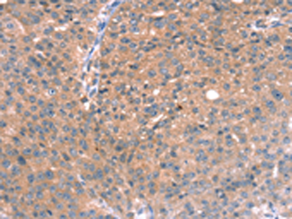 Anti-RGS5 Rabbit Polyclonal Antibody