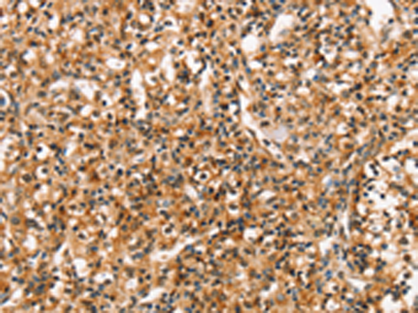 Anti-RGS1 Rabbit Polyclonal Antibody