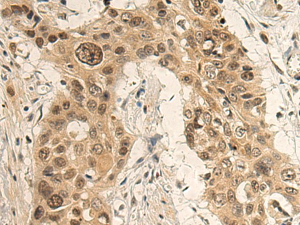Anti-RGS6 Rabbit Polyclonal Antibody