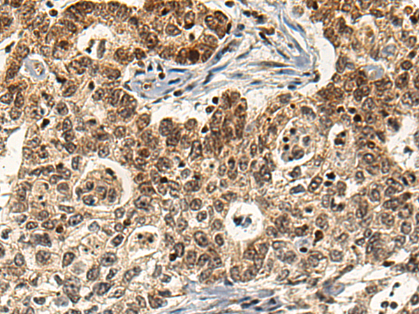 Anti-RGS14 Rabbit Polyclonal Antibody
