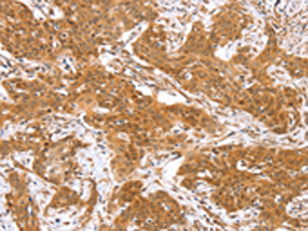 Anti-RGS22 Rabbit Polyclonal Antibody