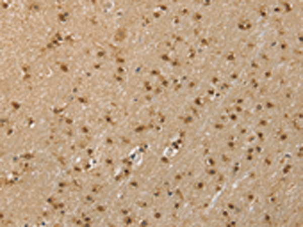Anti-RNH1 Rabbit Polyclonal Antibody