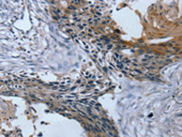 Anti-TRIM31 Rabbit Polyclonal Antibody
