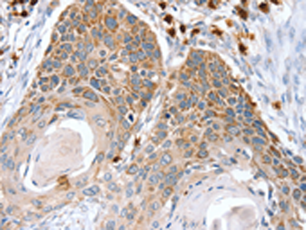 Anti-RNF185 Rabbit Polyclonal Antibody