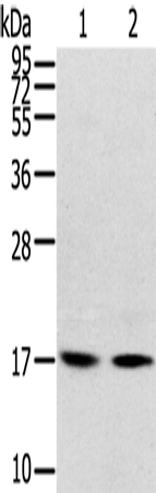 Anti-RPLP1 Rabbit Polyclonal Antibody