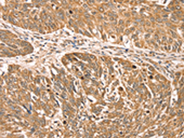Anti-RPLP2 Rabbit Polyclonal Antibody