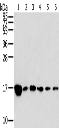 Anti-RPLP2 Rabbit Polyclonal Antibody