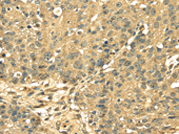 Anti-RPS3 Rabbit Polyclonal Antibody
