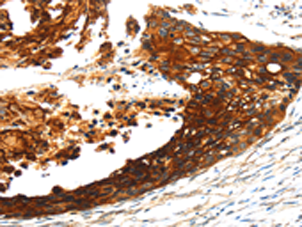 Anti-S100A14 Rabbit Polyclonal Antibody