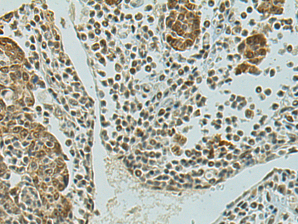 Anti-STAG1 Rabbit Polyclonal Antibody