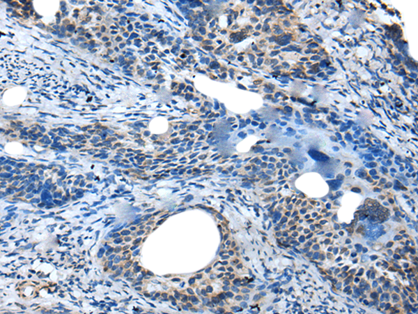 Anti-SAA4 Rabbit Polyclonal Antibody