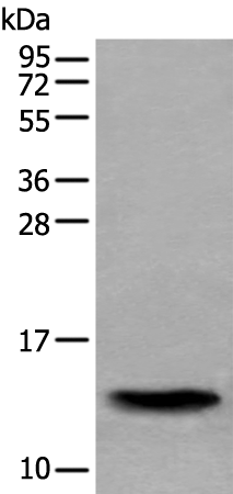 Anti-SAA4 Rabbit Polyclonal Antibody