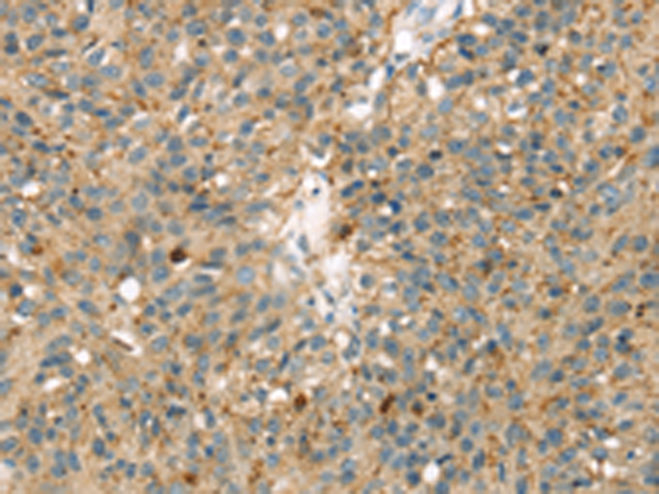 Anti-MAPK12 Rabbit Polyclonal Antibody
