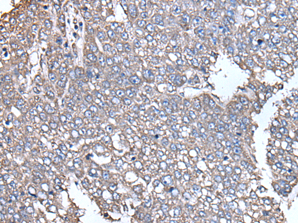 Anti-SCP2 Rabbit Polyclonal Antibody