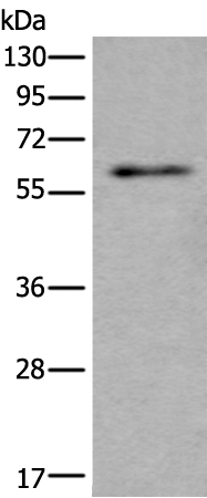 Anti-SCP2 Rabbit Polyclonal Antibody