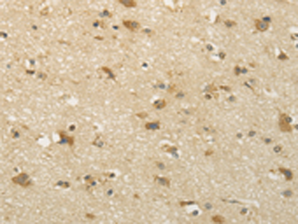 Anti-Semaphorin 4F Rabbit Polyclonal Antibody