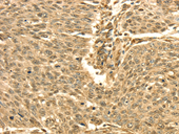 Anti-Septin 2 Rabbit Polyclonal Antibody