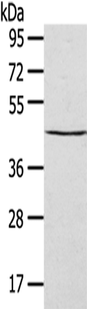 Anti-Septin 2 Rabbit Polyclonal Antibody
