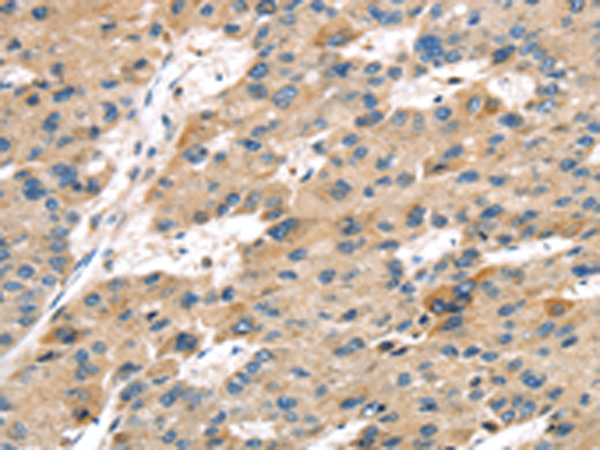 Anti-SERPINB8 Rabbit Polyclonal Antibody